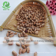 White Beans Type and Kidney Beans Type Light Speckled Kidney Beans